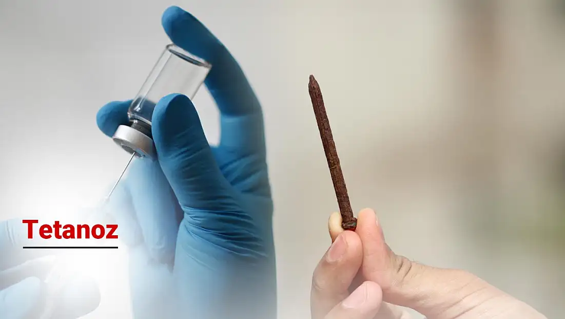 Tetanoz nedir? Tetanoz belirtileri nelerdir?