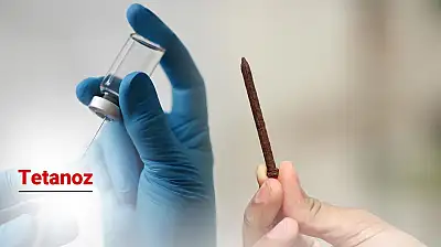 Tetanoz nedir? Tetanoz belirtileri nelerdir?