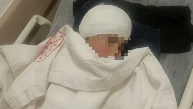 Kayseri'de köpek saldırısında yaralanan 3 yaşındaki bebek, 5 operasyon atlattı
