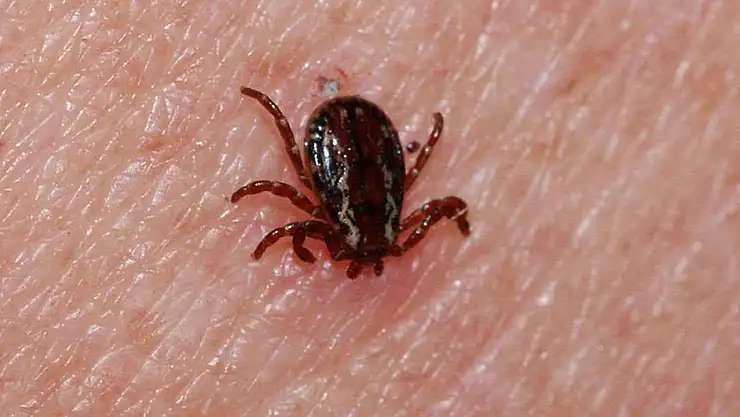 14 yaşındaki çocuk kene ısırığıyla hastanede