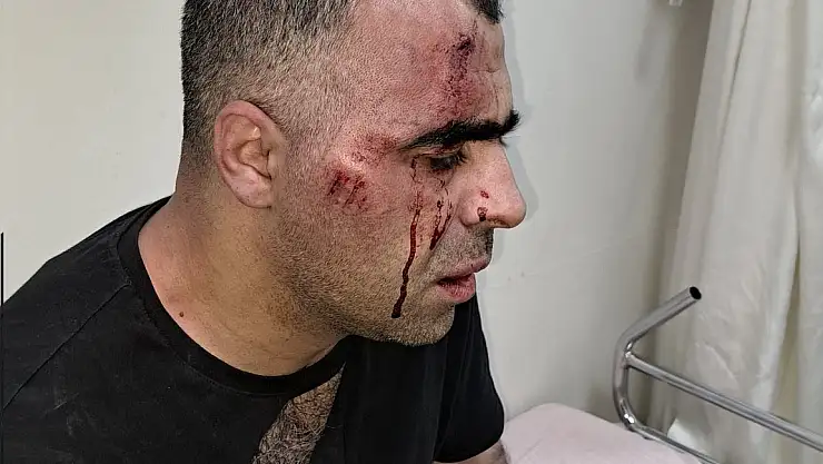 Bitlis Gazeteciler Cemiyeti Başkanı darp edildi