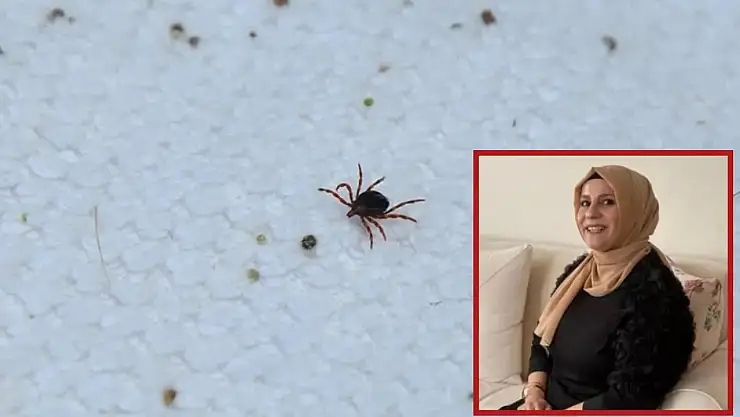 Develi'de kene Isırığı can aldı